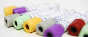 blood test tubes